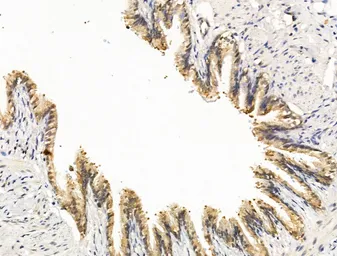Anti-NOTCH4 antibody used in IHC (Paraffin sections) (IHC-P). GTX03453