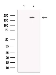 Anti-NOTCH4 antibody used in Western Blot (WB). GTX03453