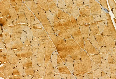 Anti-SMCR7 antibody used in IHC (Paraffin sections) (IHC-P). GTX03455
