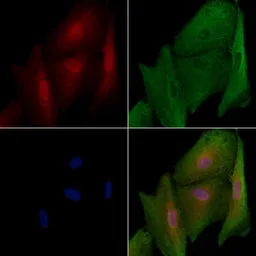Anti-MKLP1 antibody used in Immunocytochemistry/ Immunofluorescence (ICC/IF). GTX03456