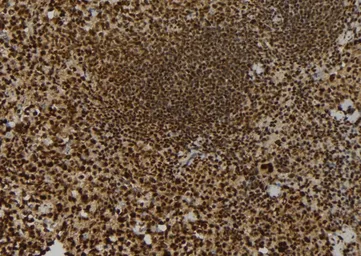 Anti-MKLP1 antibody used in IHC (Paraffin sections) (IHC-P). GTX03456