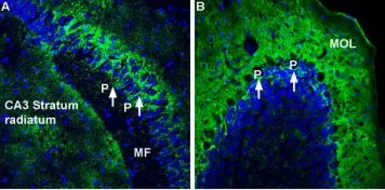 Anti-Sodium/Potassium ATPase alpha 2 antibody used in IHC (Frozen sections) (IHC-Fr). GTX03457