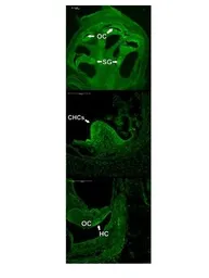 Anti-MATH1 antibody used in Immunohistochemistry (IHC). GTX03458