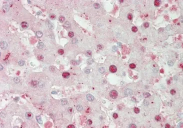 Anti-MATH1 antibody used in Immunohistochemistry (IHC). GTX03458
