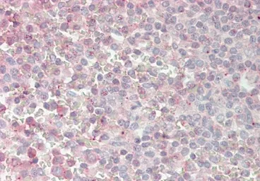 Anti-MATH1 antibody used in Immunohistochemistry (IHC). GTX03458