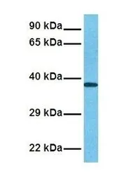 Anti-MATH1 antibody used in Western Blot (WB). GTX03458