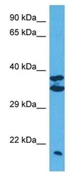 Anti-MATH1 antibody used in Western Blot (WB). GTX03458