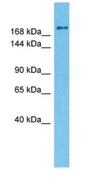Anti-gp340 antibody used in Western Blot (WB). GTX03459