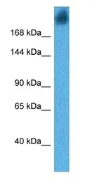 Anti-gp340 antibody used in Western Blot (WB). GTX03459