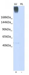 Anti-gp340 antibody used in Western Blot (WB). GTX03459