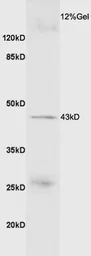 Anti-GDF8 / Myostatin antibody used in Western Blot (WB). GTX03461