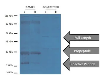 Anti-GDF8 / Myostatin antibody used in Western Blot (WB). GTX03461