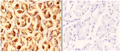Anti-CLN6 antibody used in IHC (Paraffin sections) (IHC-P). GTX03465