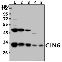 Anti-CLN6 antibody used in Western Blot (WB). GTX03465