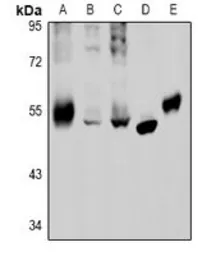 Anti-GABA A Receptor beta 2 antibody used in Western Blot (WB). GTX03471
