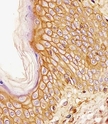 Anti-CD44 antibody [Hermes-3] used in IHC (Paraffin sections) (IHC-P). GTX03492