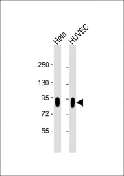 Anti-CD44 antibody [Hermes-3] used in Western Blot (WB). GTX03492