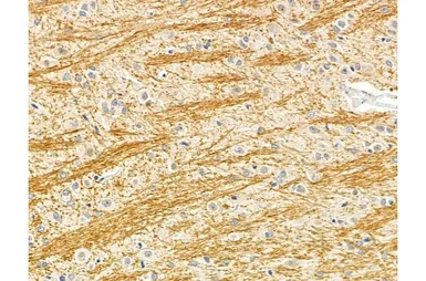 Anti-Microcephalin antibody used in IHC (Paraffin sections) (IHC-P). GTX03494