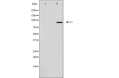 Anti-Microcephalin antibody used in Western Blot (WB). GTX03494