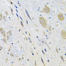 Anti-LGR6 antibody used in IHC (Paraffin sections) (IHC-P). GTX03496