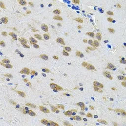 Anti-LGR6 antibody used in IHC (Paraffin sections) (IHC-P). GTX03496