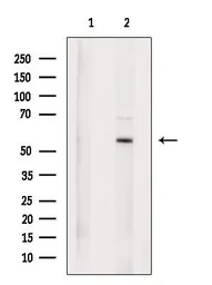 Anti-Suppressor of Fused antibody used in Western Blot (WB). GTX03498