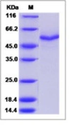 Mouse SPOCK3 protein, His tag (active). GTX03578-pro
