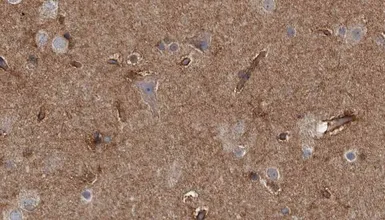 Anti-Doublecortin (phospho Ser335) antibody used in IHC (Paraffin sections) (IHC-P). GTX03587