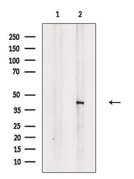 Anti-Doublecortin (phospho Ser335) antibody used in Western Blot (WB). GTX03587