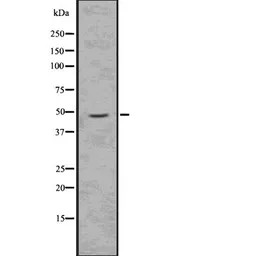 Anti-Doublecortin (phospho Ser335) antibody used in Western Blot (WB). GTX03587
