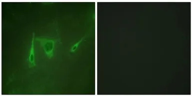 Anti-14-3-3 zeta antibody used in Immunocytochemistry/ Immunofluorescence (ICC/IF). GTX03589