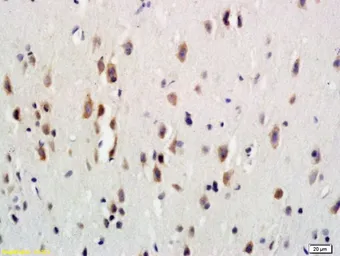 Anti-GCSF Receptor antibody used in IHC (Paraffin sections) (IHC-P). GTX03643