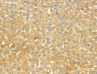Anti-Galectin 9 antibody used in IHC (Paraffin sections) (IHC-P). GTX03644