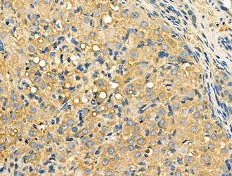 Anti-Galectin 9 antibody used in IHC (Paraffin sections) (IHC-P). GTX03644