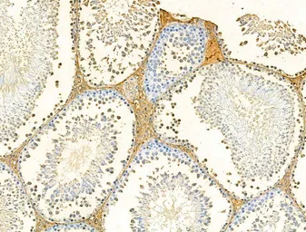 Anti-Galectin 9 antibody used in IHC (Paraffin sections) (IHC-P). GTX03644