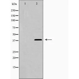 Anti-Galectin 9 antibody used in Western Blot (WB). GTX03644