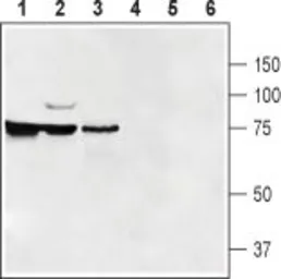 Anti-SLC47A1 antibody used in Western Blot (WB). GTX03645