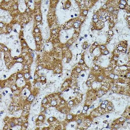 Anti-Apolipoprotein CIII antibody used in IHC (Paraffin sections) (IHC-P). GTX03650