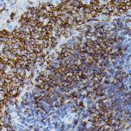 Anti-Apolipoprotein CIII antibody used in IHC (Paraffin sections) (IHC-P). GTX03650