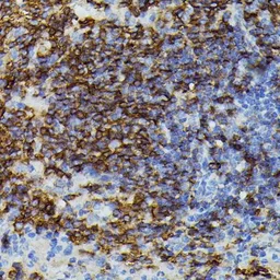 Anti-Apolipoprotein CIII antibody used in IHC (Paraffin sections) (IHC-P). GTX03650