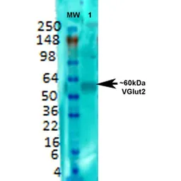 Anti-VGLUT2 antibody [S29-29] used in Western Blot (WB). GTX03657