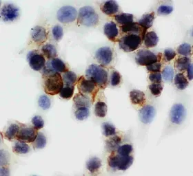 Anti-Annexin V antibody used in Immunocytochemistry/ Immunofluorescence (ICC/IF). GTX03658