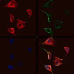 Anti-Gasdermin C antibody used in Immunocytochemistry/ Immunofluorescence (ICC/IF). GTX03667