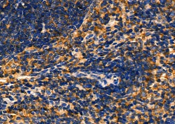 Anti-Gasdermin C antibody used in IHC (Paraffin sections) (IHC-P). GTX03667