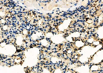Anti-Gasdermin C antibody used in IHC (Paraffin sections) (IHC-P). GTX03667