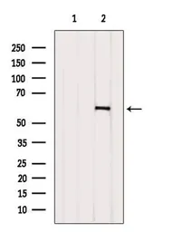 Anti-Gasdermin C antibody used in Western Blot (WB). GTX03667