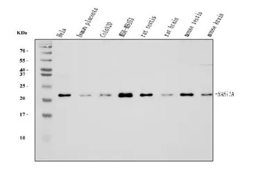 Anti-Rab11A antibody [4H9] used in Western Blot (WB). GTX03669