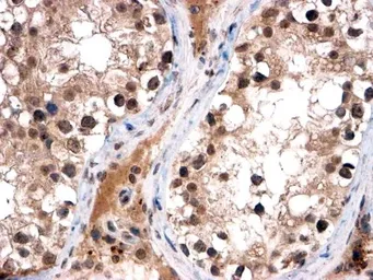 Anti-FOXI1 antibody used in IHC (Paraffin sections) (IHC-P). GTX03671