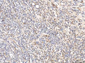 Anti-CD93 antibody used in IHC (Paraffin sections) (IHC-P). GTX03672