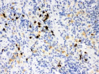 Anti-MMP8 antibody used in IHC (Paraffin sections) (IHC-P). GTX03673
